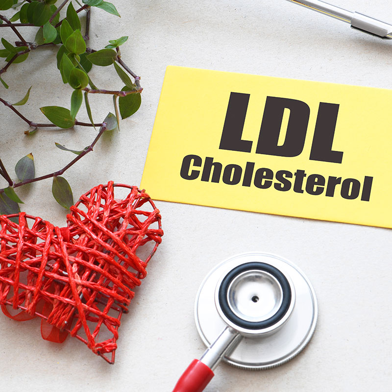 LDL cholesterol written on post it note with heart and stethoscope on table